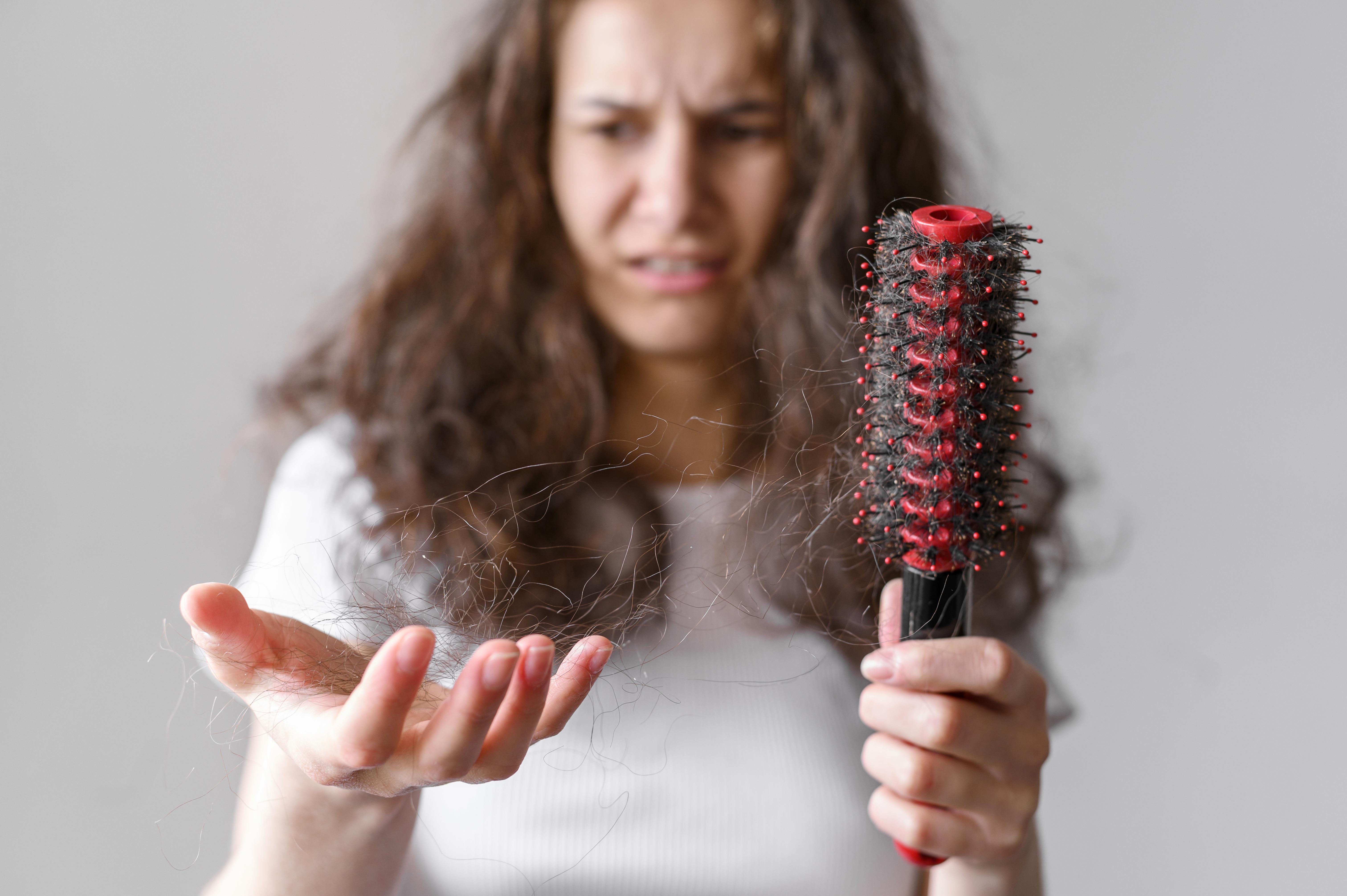 Alopecia androgenética feminina: compreendendo e lidando com a queda de cabelo